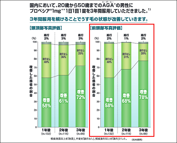 M字ハゲに対するプロペシアの効果