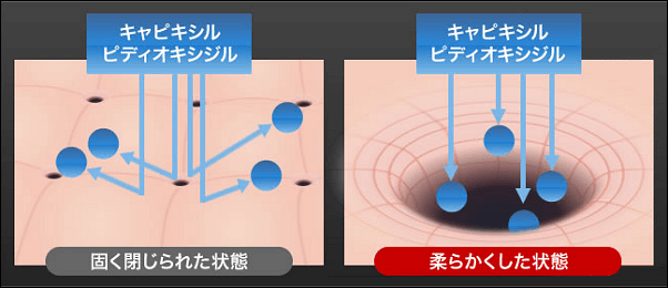 フィンジアのゲートアクセス理論