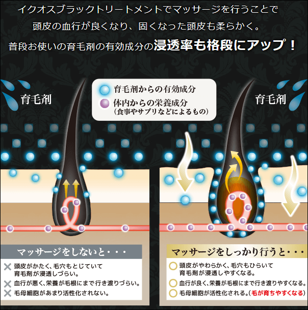 イクオスブラックシャンプーは育毛剤との相性抜群