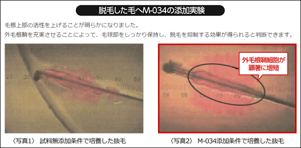 イクオスEXプラスのM-034の育毛効果