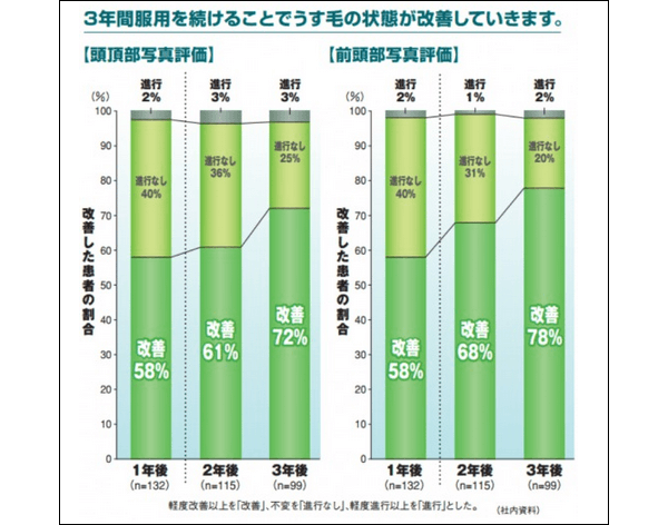 プロペシアの効果
