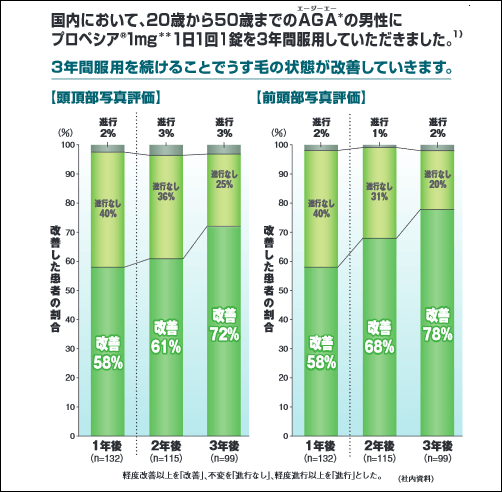 プロペシアの長期使用