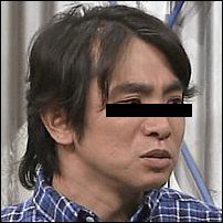 よゐこ濱口のハゲ