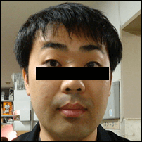 フット岩尾のハゲ