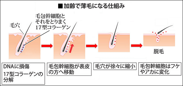 17型コラーゲン分解による薄毛
