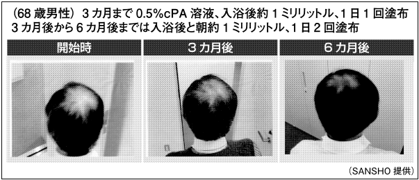 環状ホスファチジン酸（cPA）の効果