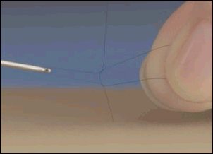 かつら・増毛の髪の毛や頭皮へのダメージ
