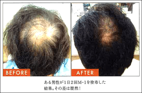 M-1ミストの効果