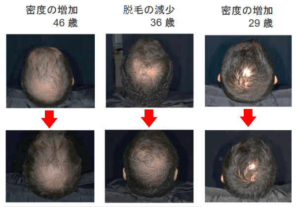 リデンシルを使った写真