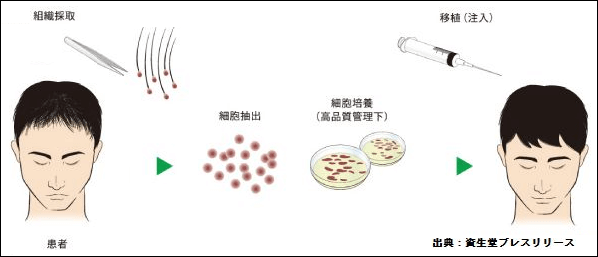 資生堂の再生治療の方法