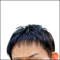 治る可能性が高いハゲ