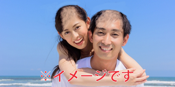 ハゲ男は薄毛女を受け入れる？