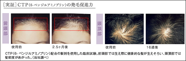 デルメッドヘアエッセンス　効果