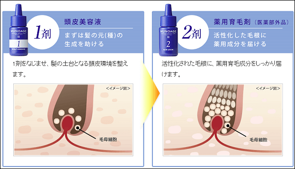 Wアプローチヘアプログラムの効果の仕組み
