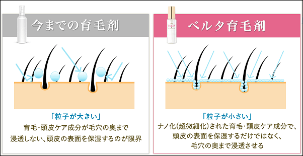 ベルタ育毛剤　ナノ化