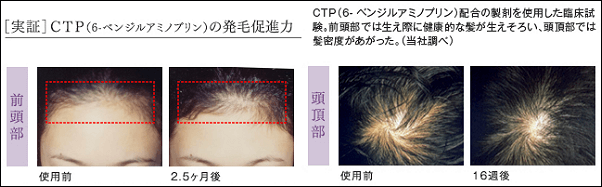 CTPの効果の実証