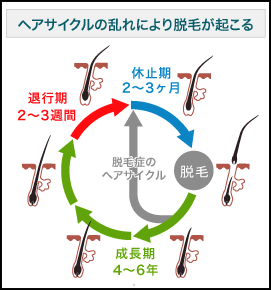 ヘアサイクルの乱れで薄毛になる