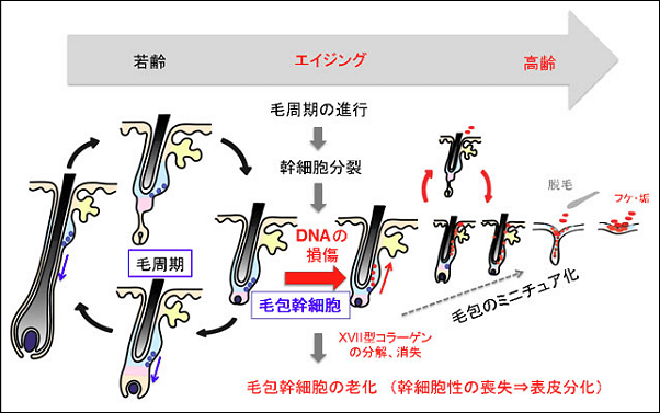 17型コラーゲン減少と薄毛の仕組み