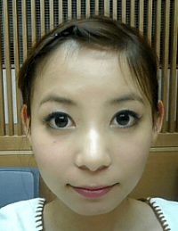 ハゲてる中川翔子