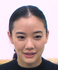 蒼井優はハゲてる？