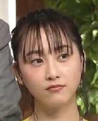 元SKE松井玲奈はハゲ？